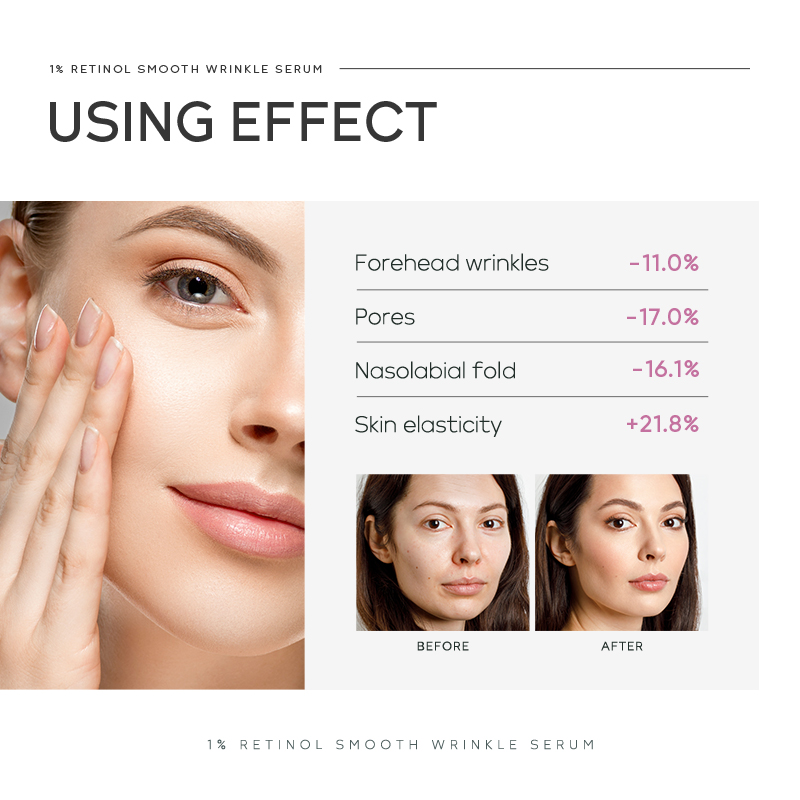 Klej do rzęs z zestawem pęset, – Eyelash Extension Eye Irritation recenzja i cena